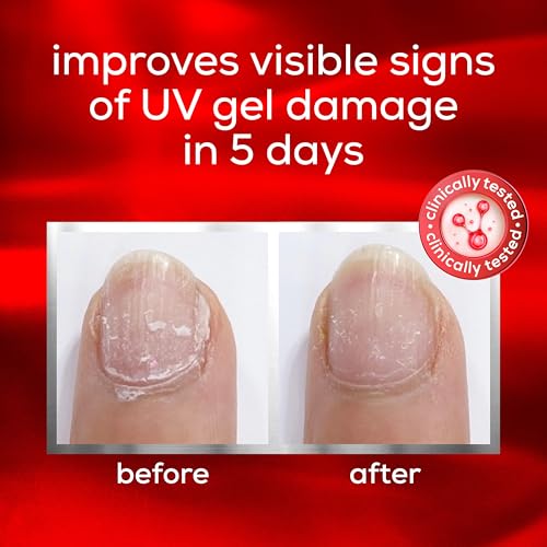 essie nail care, UV gel damage repair treatment, to the rescue nail repair base coat, 0.46 fl oz